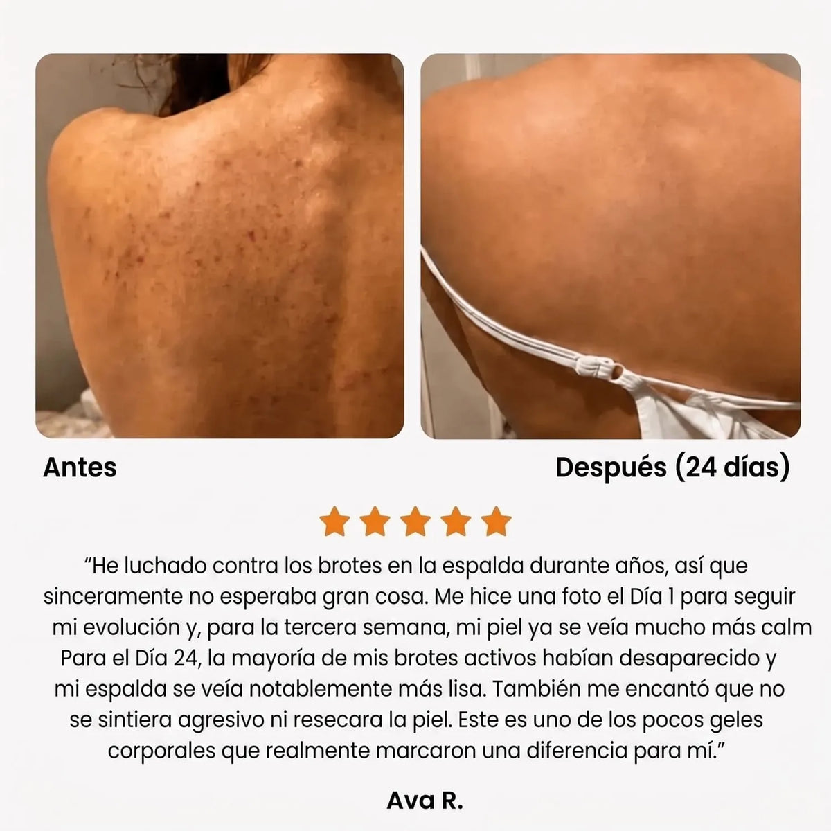 Gel de ducha antiacné Swayeo