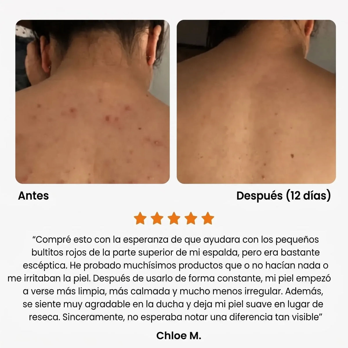 Gel de ducha antiacné Swayeo