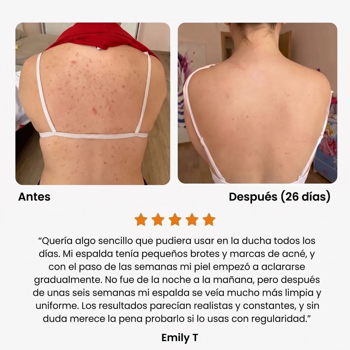 Gel de ducha antiacné Swayeo